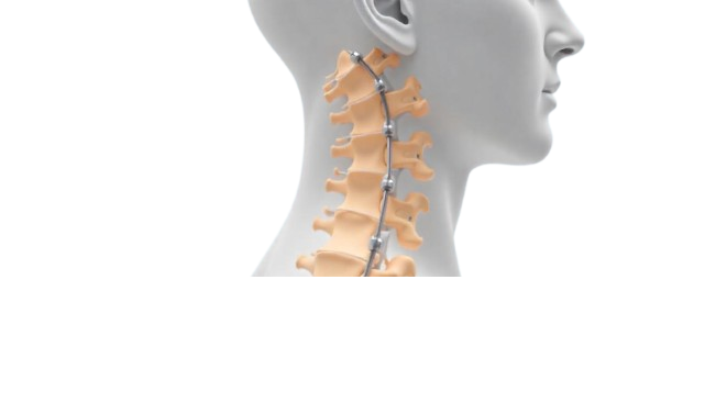 Pedicle Screw Rod Constructs healthcare platform